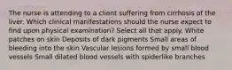 The nurse is attending to a client suffering from cirrhosis of the liver. Which clinical manifestations should the nurse expect to find upon physical examination? Select all that apply. White patches on skin Deposits of dark pigments Small areas of bleeding into the skin Vascular lesions formed by small blood vessels Small dilated blood vessels with spiderlike branches