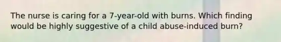 The nurse is caring for a 7-year-old with burns. Which finding would be highly suggestive of a child abuse-induced burn?