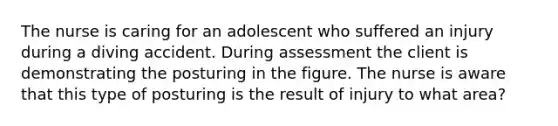 The nurse is caring for an adolescent who suffered an injury during a diving accident. During assessment the client is demonstrating the posturing in the figure. The nurse is aware that this type of posturing is the result of injury to what area?