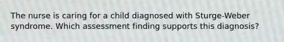 The nurse is caring for a child diagnosed with Sturge-Weber syndrome. Which assessment finding supports this diagnosis?