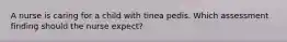 A nurse is caring for a child with tinea pedis. Which assessment finding should the nurse expect?