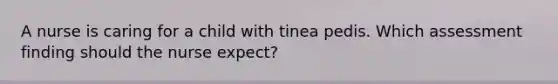 A nurse is caring for a child with tinea pedis. Which assessment finding should the nurse expect?