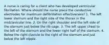 A nurse is caring for a client who has developed ventricular fibrillation. Where should the nurse place the conductive electrodes for maximum defibrillation effectiveness? 1. The left lower sternum and the right side of the thorax in the midclavicular line. 2. On the right shoulder and the left side of the sternum just below the rib cage. 3. The left upper chest to the left of the sternum and the lower right half of the sternum. 4. Below the right clavicle to the right of the sternum and just below the left nipple.