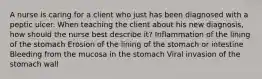 A nurse is caring for a client who just has been diagnosed with a peptic ulcer. When teaching the client about his new diagnosis, how should the nurse best describe it? Inflammation of the lining of the stomach Erosion of the lining of the stomach or intestine Bleeding from the mucosa in the stomach Viral invasion of the stomach wall
