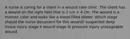 A nurse is caring for a client in a wound care clinic. The client has a wound on the right heel that is 2 cm × 4 cm. The wound is a maroon color and looks like a blood-filled blister. Which stage should the nurse document for this wound? suspected deep tissue injury stage II wound stage III pressure injury unstageable wound