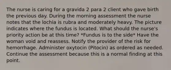 The nurse is caring for a gravida 2 para 2 client who gave birth the previous day. During the morning assessment the nurse notes that the lochia is rubra and moderately heavy. The picture indicates where the fundus is located. What should the nurse's priority action be at this time? *Fundus is to the side* Have the woman void and reassess. Notify the provider of the risk for hemorrhage. Administer oxytocin (Pitocin) as ordered as needed. Continue the assessment because this is a normal finding at this point.