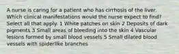 A nurse is caring for a patient who has cirrhosis of the liver. Which clinical manifestations would the nurse expect to find? Select all that apply. 1 White patches on skin 2 Deposits of dark pigments 3 Small areas of bleeding into the skin 4 Vascular lesions formed by small blood vessels 5 Small dilated blood vessels with spiderlike branches