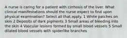 A nurse is caring for a patient with cirrhosis of the liver. What clinical manifestations should the nurse expect to find upon physical examination? Select all that apply. 1 White patches on skin 2 Deposits of dark pigments 3 Small areas of bleeding into the skin 4 Vascular lesions formed by small blood vessels 5 Small dilated blood vessels with spiderlike branches