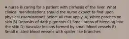 A nurse is caring for a patient with cirrhosis of the liver. What clinical manifestations should the nurse expect to find upon physical examination? Select all that apply. A) White patches on skin B) Deposits of dark pigments C) Small areas of bleeding into the skin D) Vascular lesions formed by small blood vessels E) Small dilated blood vessels with spider like branches