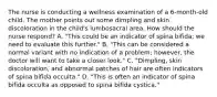 The nurse is conducting a wellness examination of a 6-month-old child. The mother points out some dimpling and skin discoloration in the child's lumbosacral area. How should the nurse respond? A. "This could be an indicator of spina bifida; we need to evaluate this further." B. "This can be considered a normal variant with no indication of a problem; however, the doctor will want to take a closer look." C. "Dimpling, skin discoloration, and abnormal patches of hair are often indicators of spina bifida occulta." D. "This is often an indicator of spina bifida occulta as opposed to spina bifida cystica."