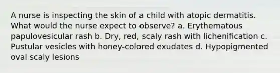 A nurse is inspecting the skin of a child with atopic dermatitis. What would the nurse expect to observe? a. Erythematous papulovesicular rash b. Dry, red, scaly rash with lichenification c. Pustular vesicles with honey-colored exudates d. Hypopigmented oval scaly lesions