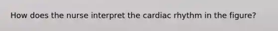 How does the nurse interpret the cardiac rhythm in the figure?