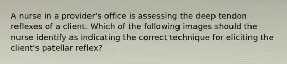 A nurse in a provider's office is assessing the deep tendon reflexes of a client. Which of the following images should the nurse identify as indicating the correct technique for eliciting the client's patellar reflex?