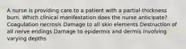 A nurse is providing care to a patient with a partial-thickness burn. Which clinical manifestation does the nurse anticipate? Coagulation necrosis Damage to all skin elements Destruction of all nerve endings Damage to epidermis and dermis involving varying depths