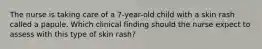 The nurse is taking care of a 7-year-old child with a skin rash called a papule. Which clinical finding should the nurse expect to assess with this type of skin rash?