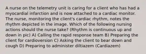 A nurse on the telemetry unit is caring for a client who has had a myocardial infarction and is now attached to a cardiac monitor. The nurse, monitoring the client's cardiac rhythm, notes the rhythm depicted in the image. Which of the following nursing actions should the nurse take? (Rhythm is continuous up and down in pic) A) Calling the rapid response team B) Preparing the client for cardioversion C) Asking the client to bear down and cough D) Preparing to administer diltiazem (Cardiazem)