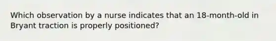 Which observation by a nurse indicates that an 18-month-old in Bryant traction is properly positioned?