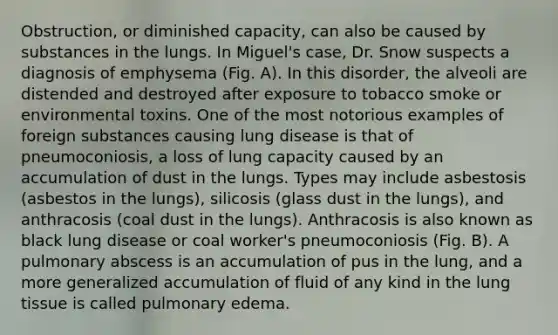 Obstruction, or diminished capacity, can also be caused by substances in the lungs. In Miguel's case, Dr. Snow suspects a diagnosis of emphysema (Fig. A). In this disorder, the alveoli are distended and destroyed after exposure to tobacco smoke or environmental toxins. One of the most notorious examples of foreign substances causing lung disease is that of pneumoconiosis, a loss of lung capacity caused by an accumulation of dust in the lungs. Types may include asbestosis (asbestos in the lungs), silicosis (glass dust in the lungs), and anthracosis (coal dust in the lungs). Anthracosis is also known as black lung disease or coal worker's pneumoconiosis (Fig. B). A pulmonary abscess is an accumulation of pus in the lung, and a more generalized accumulation of fluid of any kind in the lung tissue is called pulmonary edema.