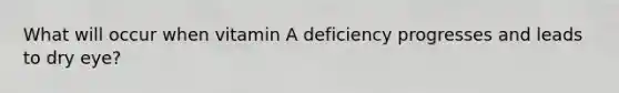 What will occur when vitamin A deficiency progresses and leads to dry eye?