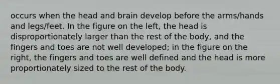 occurs when the head and brain develop before the arms/hands and legs/feet. In the figure on the left, the head is disproportionately larger than the rest of the body, and the fingers and toes are not well developed; in the figure on the right, the fingers and toes are well defined and the head is more proportionately sized to the rest of the body.