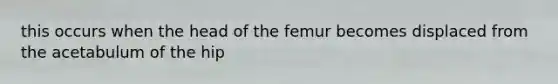 this occurs when the head of the femur becomes displaced from the acetabulum of the hip