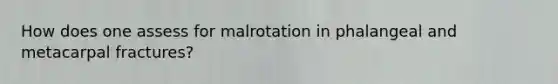 How does one assess for malrotation in phalangeal and metacarpal fractures?