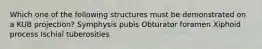 Which one of the following structures must be demonstrated on a KUB projection? Symphysis pubis Obturator foramen Xiphoid process Ischial tuberosities