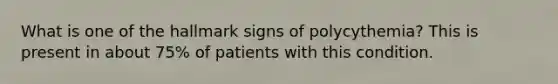 What is one of the hallmark signs of polycythemia? This is present in about 75% of patients with this condition.