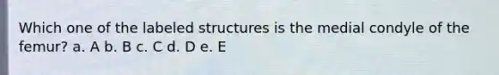 Which one of the labeled structures is the medial condyle of the femur? a. A b. B c. C d. D e. E