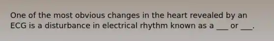 One of the most obvious changes in the heart revealed by an ECG is a disturbance in electrical rhythm known as a ___ or ___.