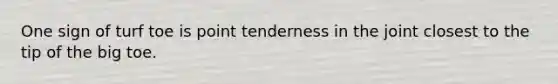 One sign of turf toe is point tenderness in the joint closest to the tip of the big toe.