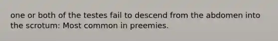 one or both of the testes fail to descend from the abdomen into the scrotum: Most common in preemies.