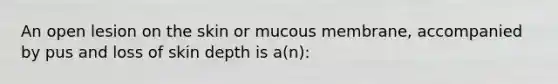 An open lesion on the skin or mucous membrane, accompanied by pus and loss of skin depth is a(n):