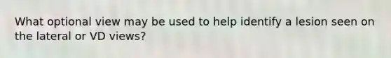 What optional view may be used to help identify a lesion seen on the lateral or VD views?