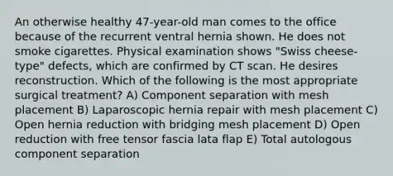 An otherwise healthy 47-year-old man comes to the office because of the recurrent ventral hernia shown. He does not smoke cigarettes. Physical examination shows "Swiss cheese-type" defects, which are confirmed by CT scan. He desires reconstruction. Which of the following is the most appropriate surgical treatment? A) Component separation with mesh placement B) Laparoscopic hernia repair with mesh placement C) Open hernia reduction with bridging mesh placement D) Open reduction with free tensor fascia lata flap E) Total autologous component separation