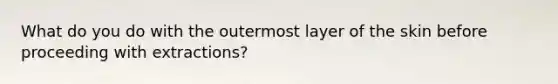 What do you do with the outermost layer of the skin before proceeding with extractions?