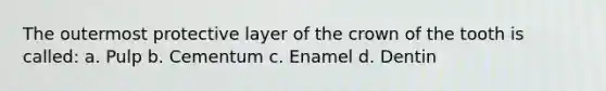 The outermost protective layer of the crown of the tooth is called: a. Pulp b. Cementum c. Enamel d. Dentin