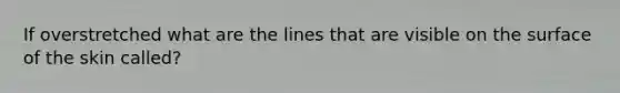 If overstretched what are the lines that are visible on the surface of the skin called?