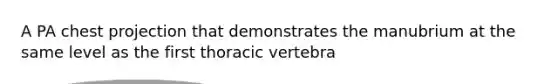 A PA chest projection that demonstrates the manubrium at the same level as the first thoracic vertebra