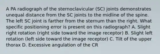 A PA radiograph of the sternoclavicular (SC) joints demonstrates unequal distance from the SC joints to the midline of the spine. The left SC joint is farther from the sternum than the right. What specific positioning error is present on this radiograph? A. Slight right rotation (right side toward the image receptor) B. Slight left rotation (left side toward the image receptor) C. Tilt of the upper thorax D. Excessive angulation of the CR