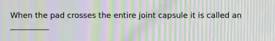 When the pad crosses the entire joint capsule it is called an __________