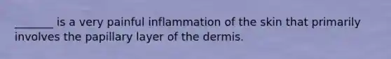 _______ is a very painful inflammation of the skin that primarily involves the papillary layer of the dermis.