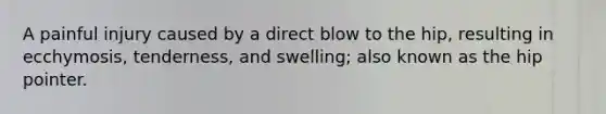 A painful injury caused by a direct blow to the hip, resulting in ecchymosis, tenderness, and swelling; also known as the hip pointer.