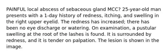 PAINFUL local abscess of sebaceous gland MCC? 25-year-old man presents with a 1-day history of redness, itching, and swelling in the right upper eyelid. The redness has increased; there has been no eye discharge or watering. On examination, a pustular swelling at the root of the lashes is found. It is surrounded by redness, and it is tender on palpation. The lesion is shown in the image.