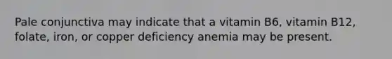 Pale conjunctiva may indicate that a vitamin B6, vitamin B12, folate, iron, or copper deficiency anemia may be present.