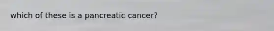 which of these is a pancreatic cancer?