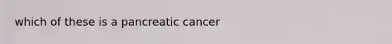 which of these is a pancreatic cancer