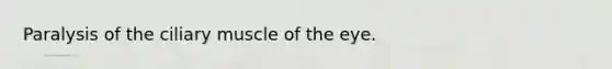Paralysis of the ciliary muscle of the eye.