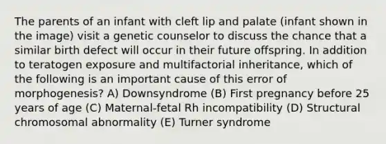 The parents of an infant with cleft lip and palate (infant shown in the image) visit a genetic counselor to discuss the chance that a similar birth defect will occur in their future offspring. In addition to teratogen exposure and multifactorial inheritance, which of the following is an important cause of this error of morphogenesis? A) Downsyndrome (B) First pregnancy before 25 years of age (C) Maternal-fetal Rh incompatibility (D) Structural chromosomal abnormality (E) Turner syndrome