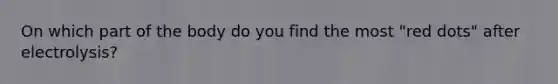 On which part of the body do you find the most "red dots" after electrolysis?